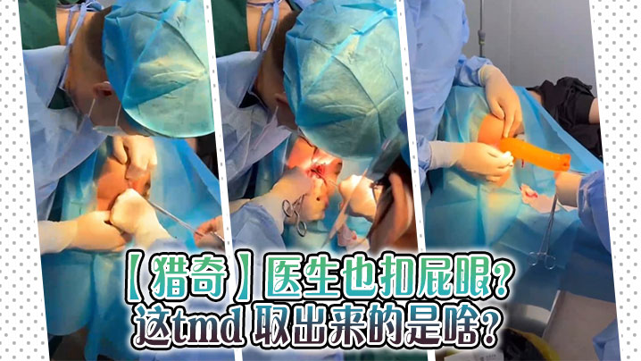 猎奇医生也扣屁眼这tmd取出来的是啥.